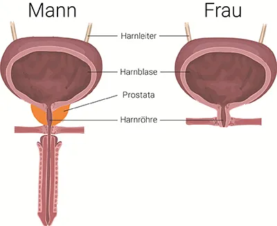 Harnblase Mann Frau